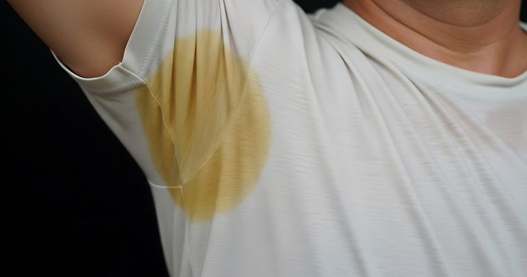 Camisa blanca con el cerco amarillento marcado en la axila